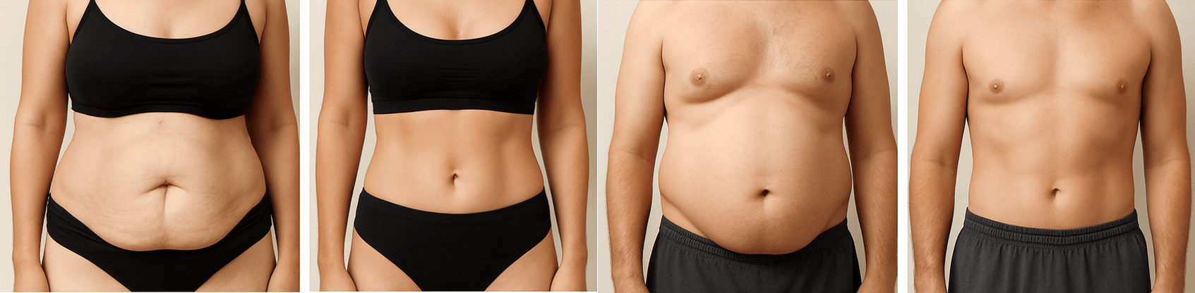 hasplasztika eredménye